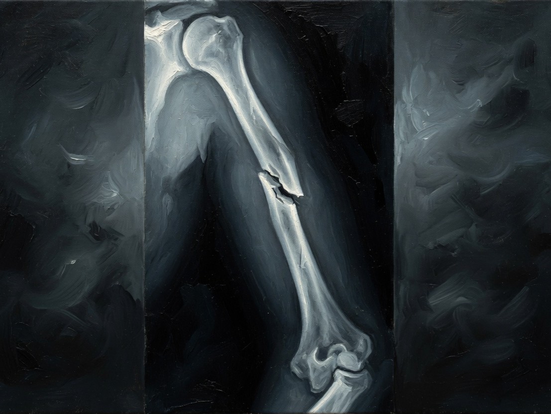 What to expect when your kid breaks a bone 2